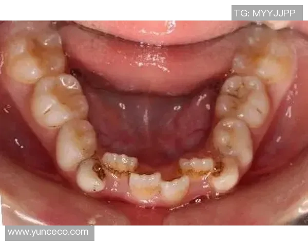 足球球星换牙事件揭秘 从牙齿到笑容的背后故事 足球球星换牙事件揭秘 从牙齿到笑容的背后故事